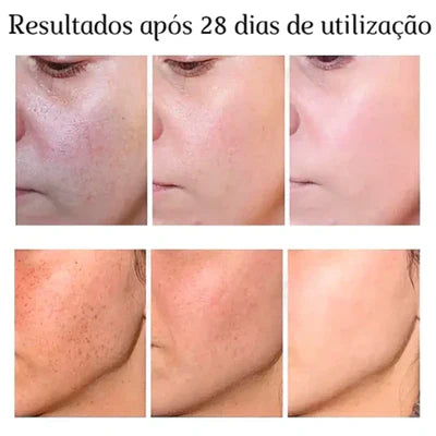 Creme Clareador de Virilha e Axilas - Clareia Skin™ |FRETE GRÁTIS|